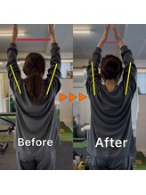 リライズ(re.RAIZE)/30代女性　頭痛もでる肩こり改善