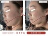 【フェイシャル】韓国最新小顔ケア《理想の輪郭形成》Redshot 4CC 90分