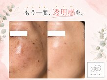 サロンサイ(salonsai)