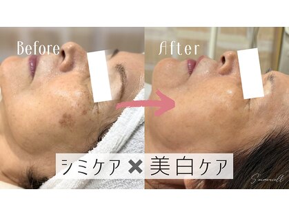 セメヴェール(Saimervell)の写真