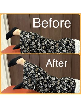 カイロライフケアサポートプラス リペア(Repair)/骨盤調整