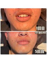 シンバ 倉敷店(SIMBA)/