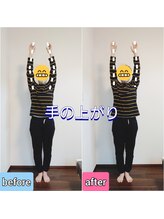 エンビジョン(ENVISION)/before→after