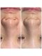 クラリ(Clari)の写真/頑固な毛穴詰まり・黒ずみ撃退！毛穴悩みに特化した最強毛穴洗浄セットキャンペーン実施中[大濠公園駅2分]