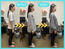 京都中丸整体カイロプラクティック/不良姿勢