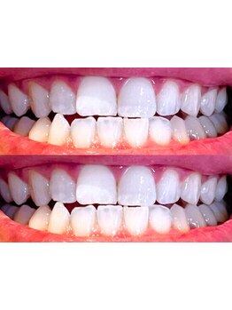 小顔になりたい