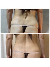 スリーピングビューティー(Sleeping Beauty)/