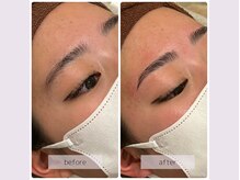 リバース(Rebirth)/毛量の少ない方は特におすすめ