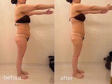 クロレ 浦和店(CLORE)/40代お客様/10回施術