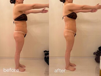 クロレ 浦和店(CLORE)/40代お客様/10回施術