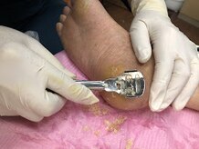 フットナース ケー(K)