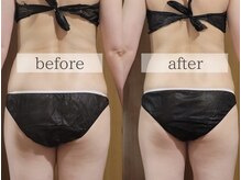 コルッソ(CoLusson.)/オーダーボディトリートメント90