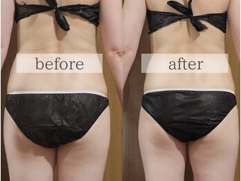 コルッソ(CoLusson.)/オーダーボディトリートメント90