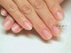 トラストネイル 垂水(TRUST NAIL)の写真/TRUST NAILのフィルインは驚きの長持ち！深爪育成/巻き爪矯正などの爪悩み解決サロン♪実証画像ご紹介中◎