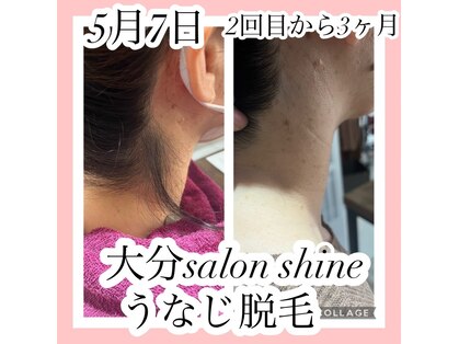 サロンシャイン(Salon Shine)の写真