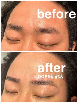 【DOPE:ドープ】新宿駅前（メンズ眉毛サロン/眉毛専門/アイブロウ/眉毛パーマ/まゆげ)/[メンズ/眉毛/アイブロウ/新宿]