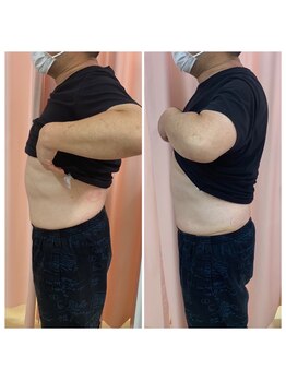 マイティー整骨院 ココア(CoCoa)/痩身マシン