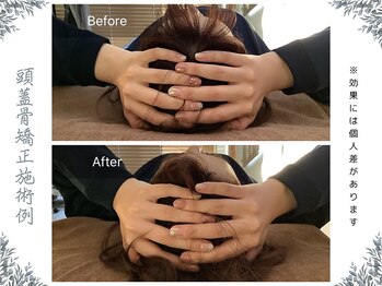 ボディ リセット アンド デザイン(Body Reset & Design)/【施術例】ビフォーアフター