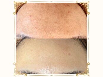 ベルーム(BellRoom)/