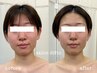 10時～13時限定【むくみ解消＊】クイック小顔コルギ＋デコルテ(50分) ¥9350→