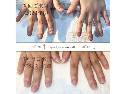 ネイルサロン ラグゼ(Nail salon Luxe)の写真