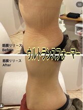 ロゼッティ(ROSETTY)/痩身/ウルトランスフォーマー