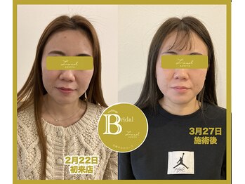 ルク ソル(Luxsol)/ブライダルエステ 姿勢矯正コミ