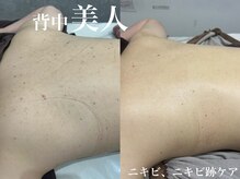 ファースト(1st)