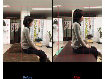 ストレチックス 近江八幡店/BeforeAfter