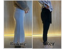 整体ラルース 中目黒(LALUZ)/30代　女性　産後骨盤矯正　変化