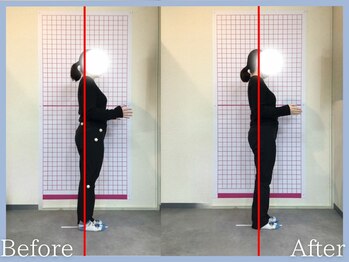 トロ整骨院(toro整骨院)/骨盤矯正★1回の効果★20代女性