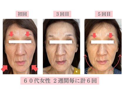 アドレル(Adorer)の写真