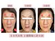 アドレル(Adorer)の写真