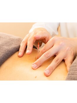 鍼灸施術を受けたい