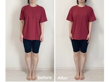 ニコディア(nico-dia)/全身矯正