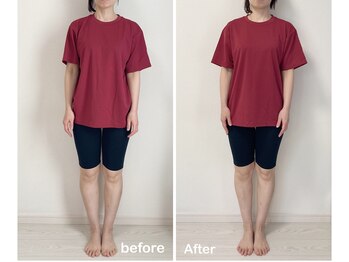 ニコディア(nico-dia)/全身矯正