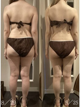 マロー(Mallow)/キャビテーションのビフォアフ