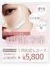 【冬限定・肌質改善クリアプラン】プレミア小顔ケア★サーマルフラクショナル
