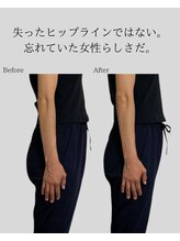 リ バース 立川(RE:birth)/美尻　BeforeAfter