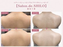 サロン ド シロ 麻布十番(salon.de.SHILO)の雰囲気（シェービング後の効果実感！[背中/ブライダルシェービング/毛穴]）