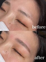 ボアップ(boappu)/ビビブロウリフト