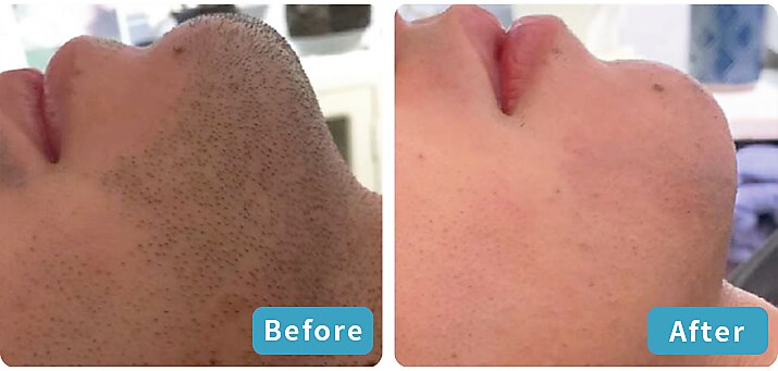 セルフエステBB あけのアクロス店｜ホットペッパービューティー