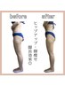 【本気痩せ☆疲労回復】ハイパーナイフEX&シェイプ脂肪燃焼&オイルリンパ