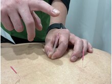 成城ていくけあ鍼灸整骨院/腰痛撃退のお手伝いいたします！