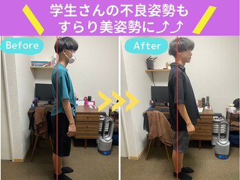 京都中丸整体カイロプラクティック/【学生】不良姿勢