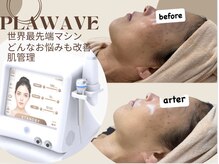 エピリア(Epilear)/新マシン　プラウェーブ