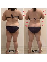 スペチアーレ 夙川/要らない脂肪はトイレに流す