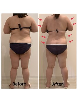 スペチアーレ 夙川/要らない脂肪はトイレに流す