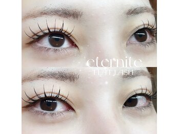 エテルニテ(eternite)/