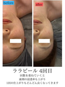 ユフラ(Juhla)/ララピール